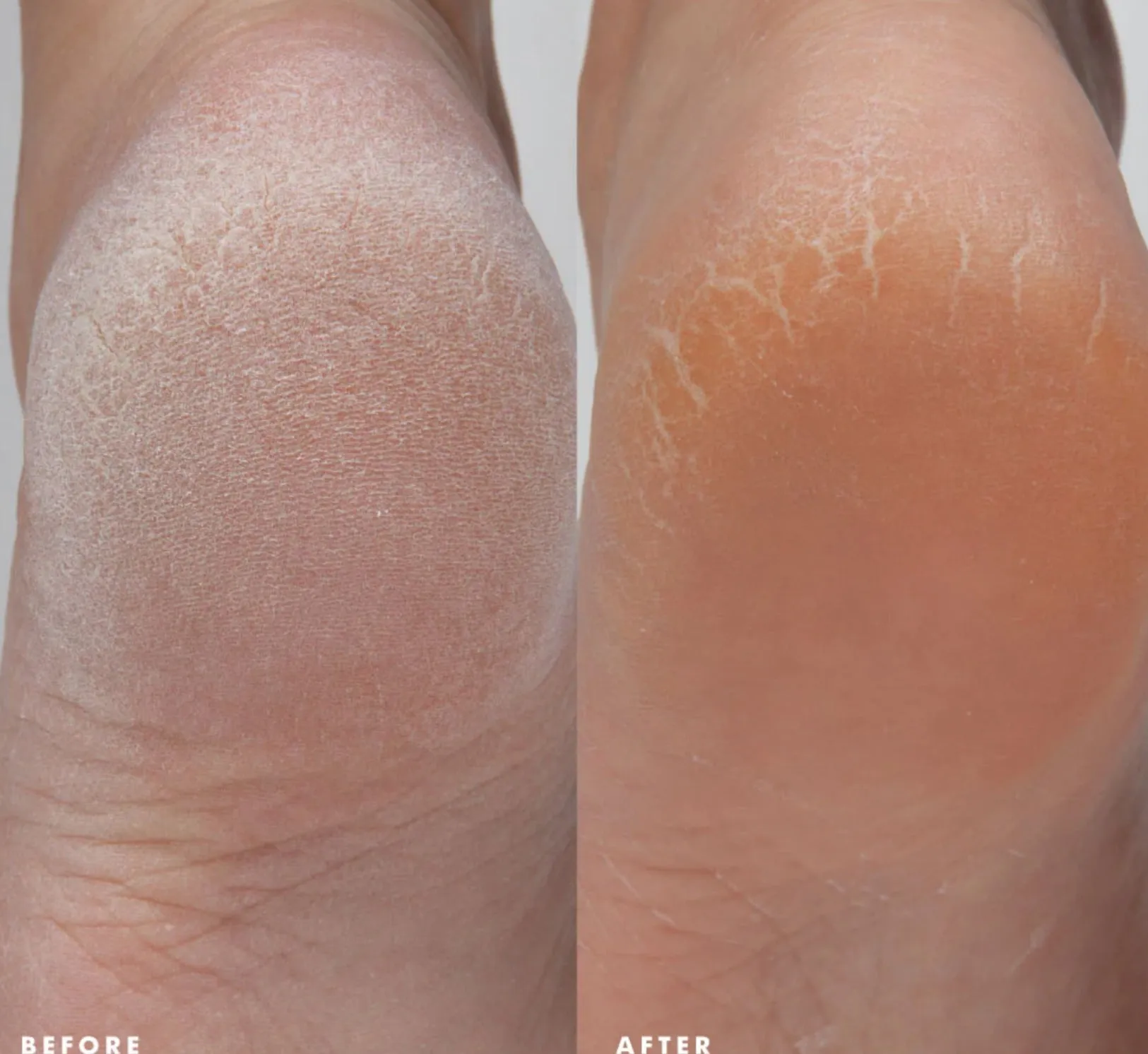 ENRICH-MINT Foot Rescue